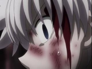 Hunter x Hunter 2011 - Episodio 101 - Ikarugo e raios